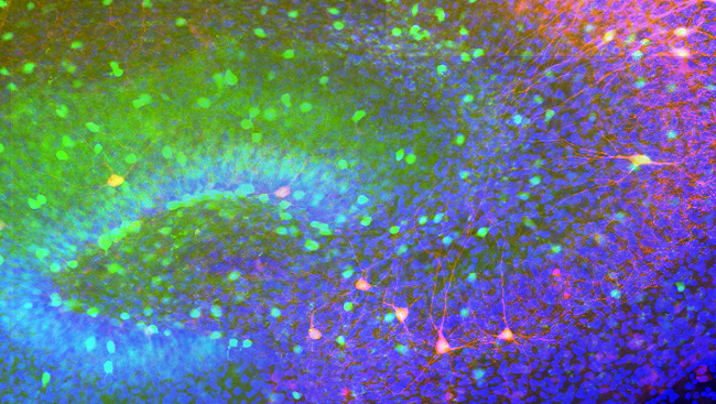 A cross-section of a mouse hippocampus.
